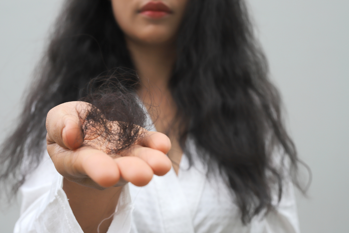 Hair Fall After Stress: Causes, Recovery Timeline & Effective Treatments