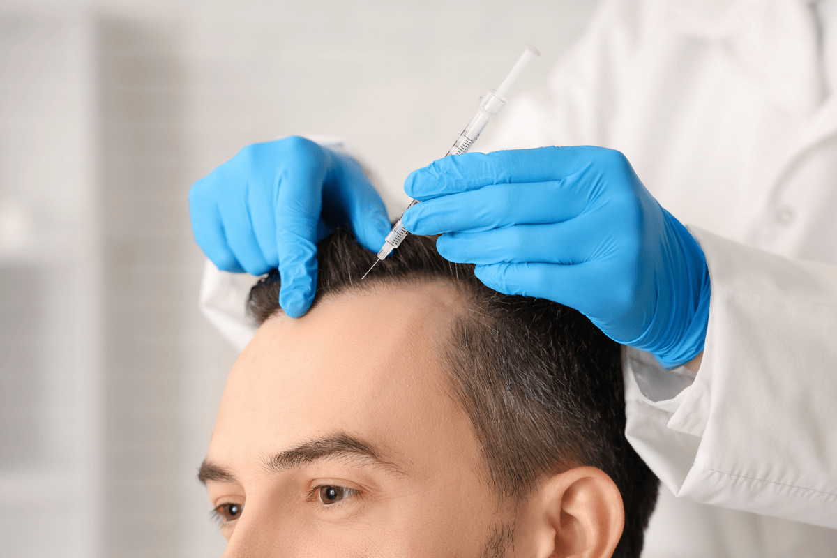 Minoxidil vs Peptides vs Rosemary Oil: Which Hair Loss Treatment Works Best?