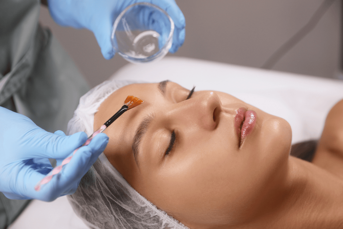 How Chemical Peels Work on Glowing Skin?