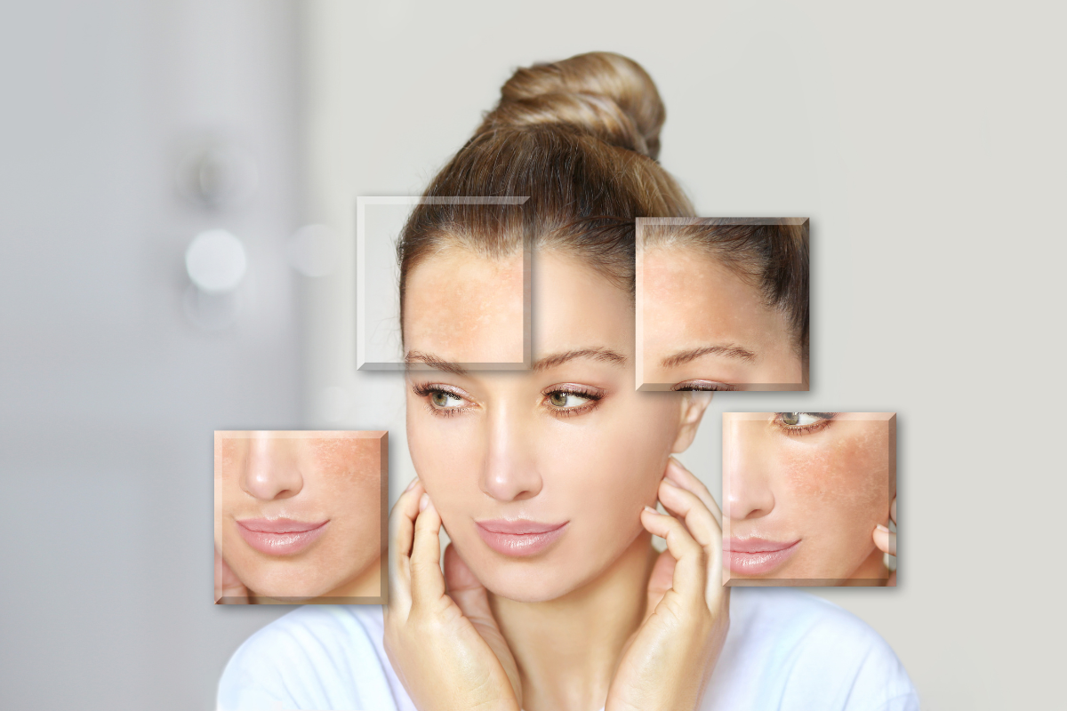 How to Reverse the Skin Damage of Hard Water and Pollution After a Summer Vacation?
