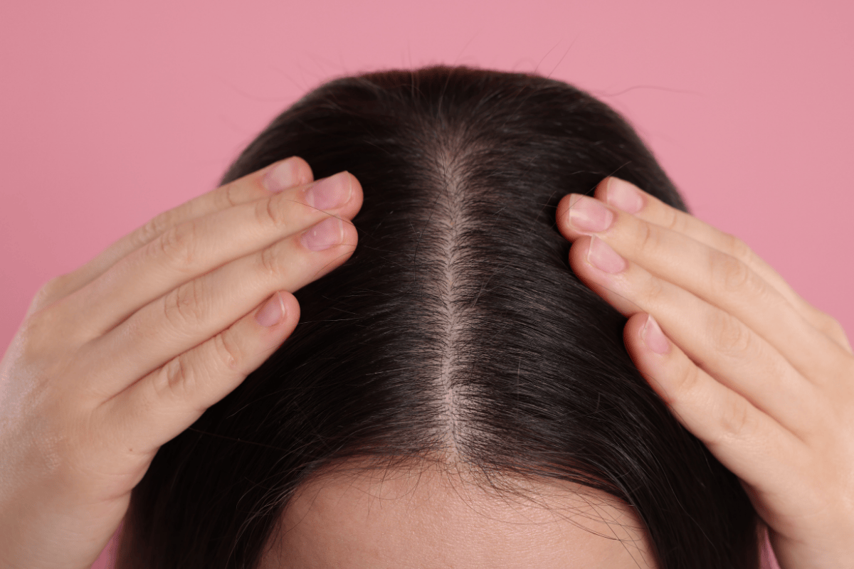What is the Role of Scalp Health in Hair Growth?